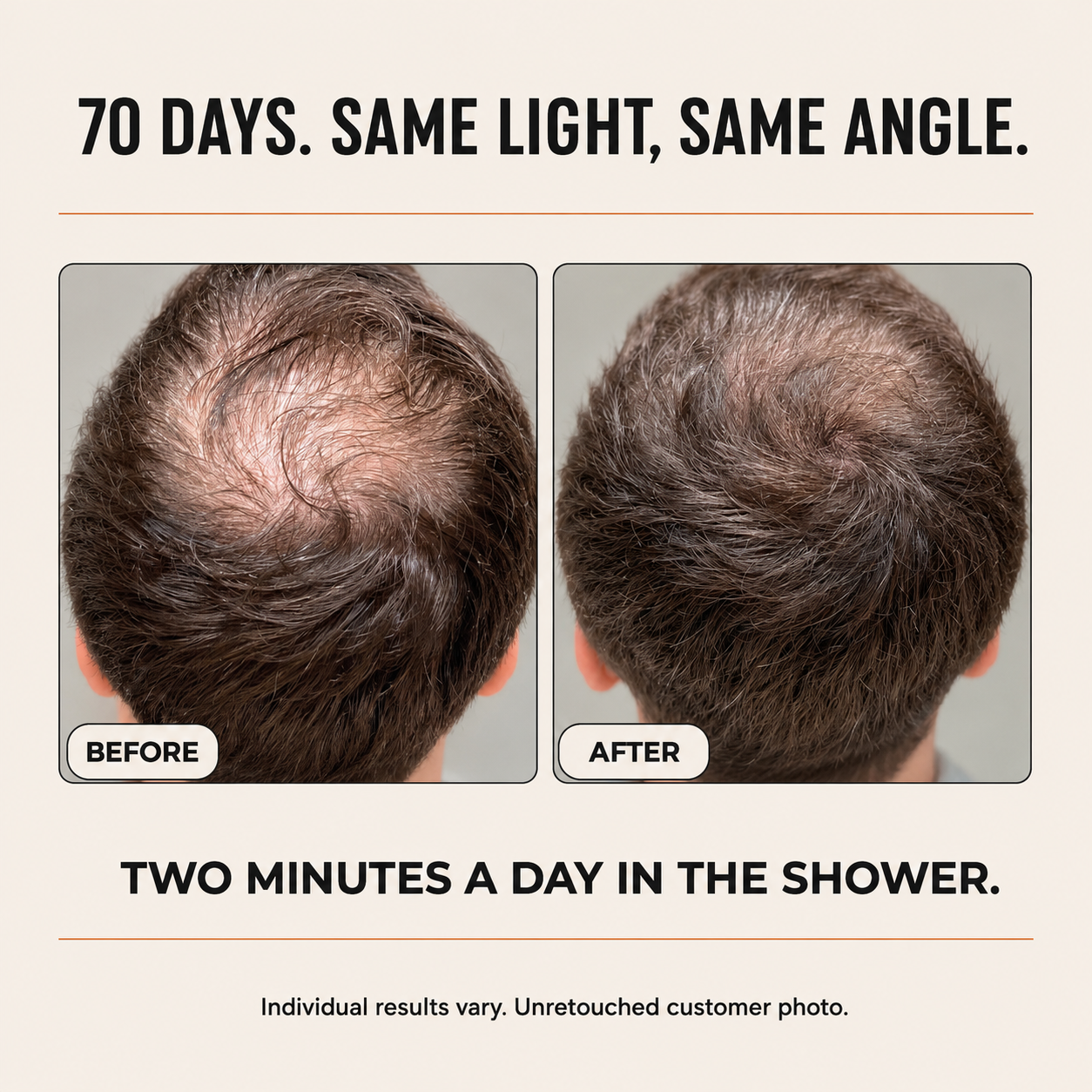 Thicker, Fuller-Looking Hair in 2 Minutes a Day With Root Activator Shampoo