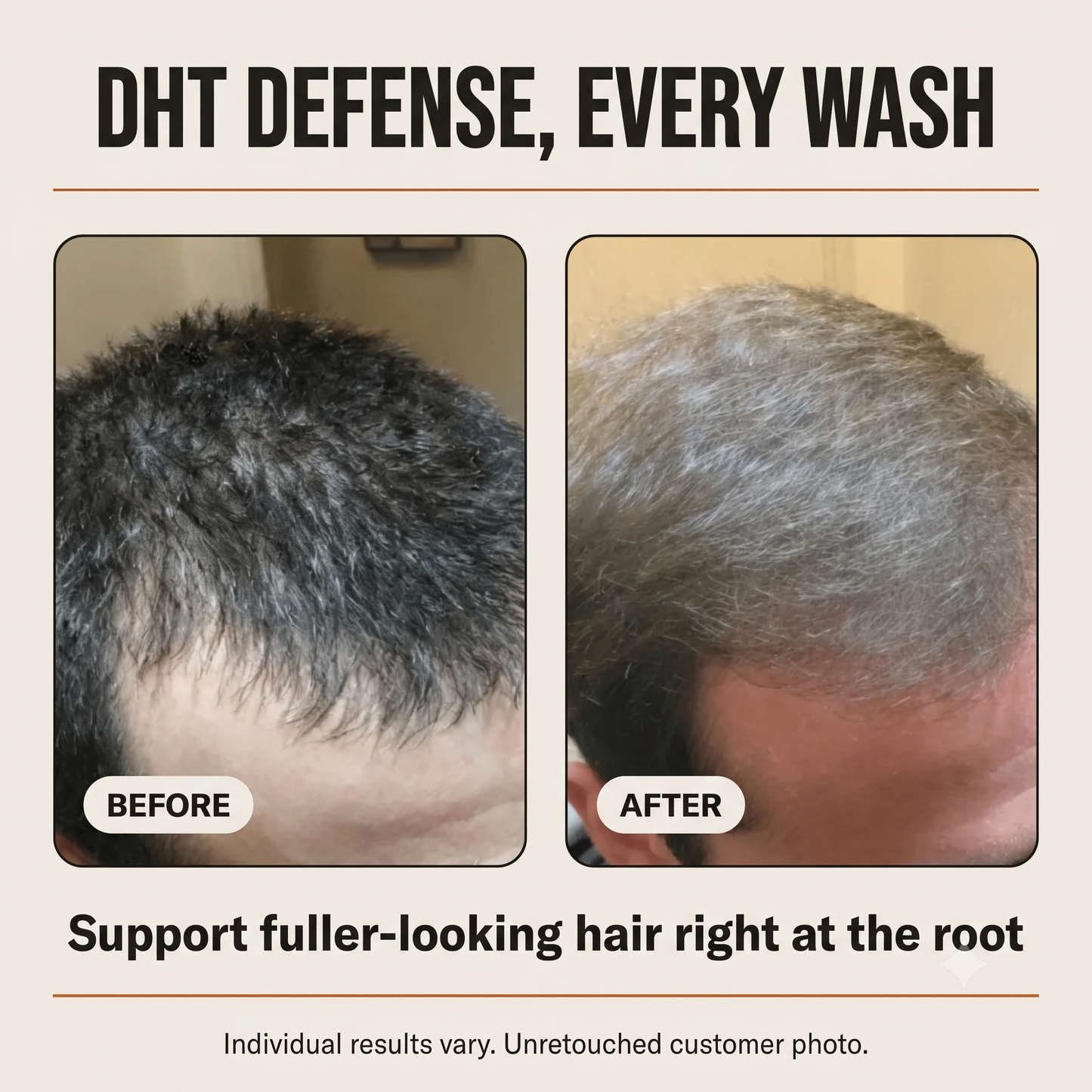 Thicker, Fuller-Looking Hair in 2 Minutes a Day With Root Activator Shampoo
