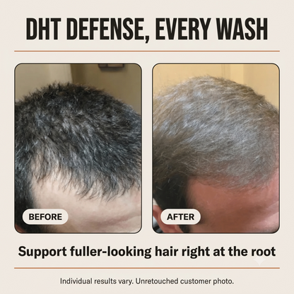 Thicker, Fuller-Looking Hair in 2 Minutes a Day With Root Activator Shampoo