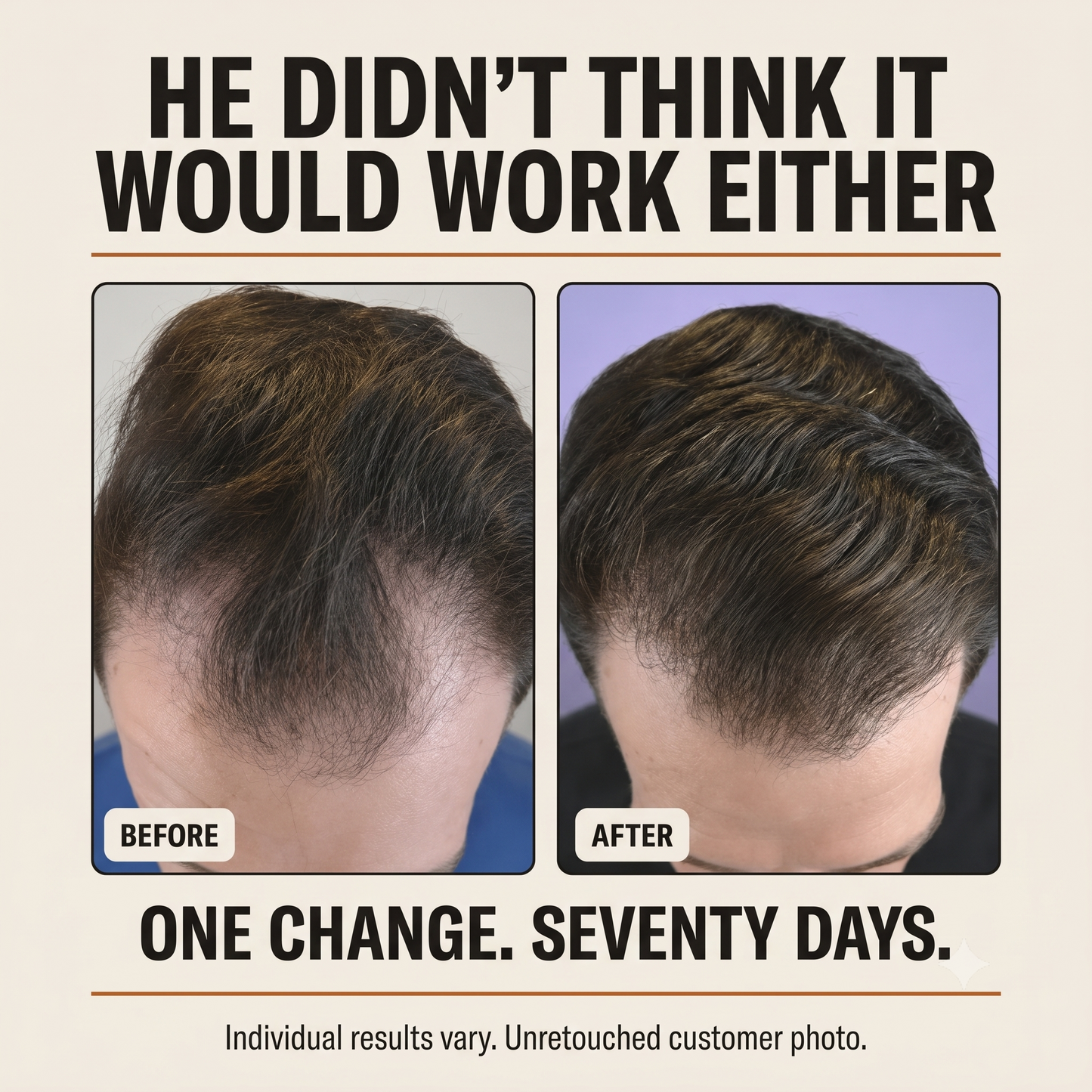 Thicker, Fuller-Looking Hair in 2 Minutes a Day With Root Activator Shampoo