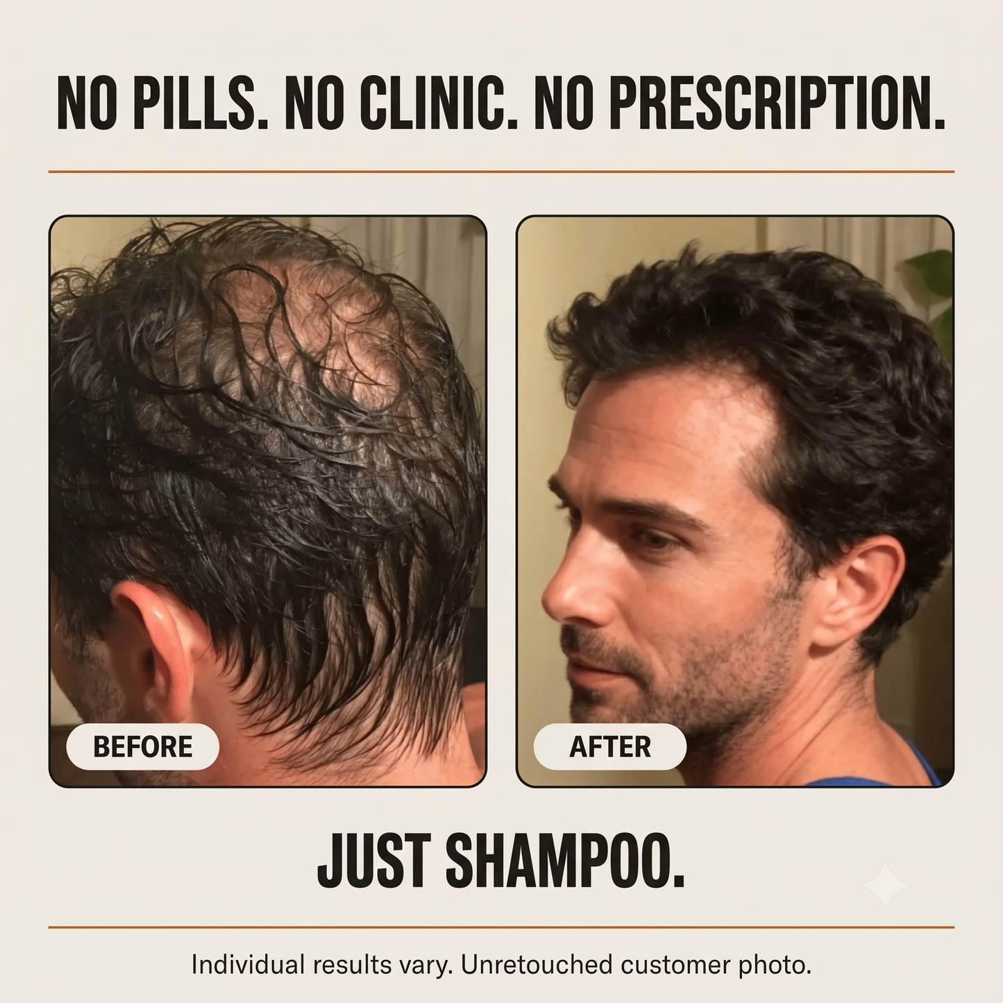 Thicker, Fuller-Looking Hair in 2 Minutes a Day With Root Activator Shampoo
