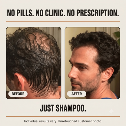 Thicker, Fuller-Looking Hair in 2 Minutes a Day With Root Activator Shampoo